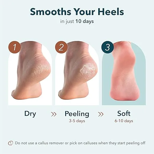 Purederm Exfoliating Heel Mask (1 Pair) – Heel Peeling Masks Gently Remove calluses from Your Heel
